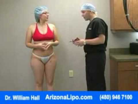 chin liposuction offshore