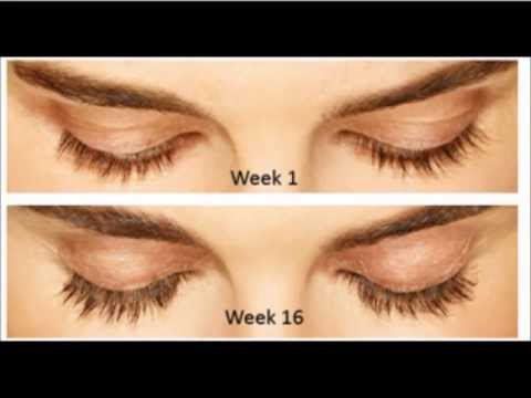Bimatoprost Eyelash Growth Uk