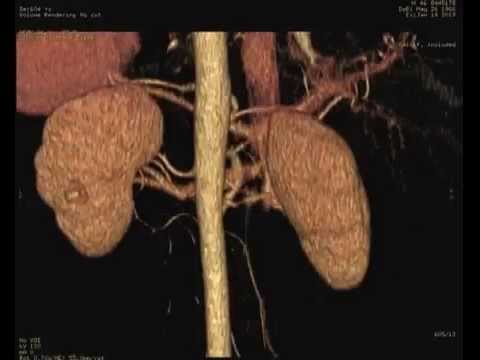 Chimiothérapie nourriture centre radiotherapie amiens