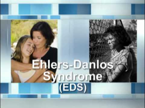 What Is Ehlers-Danlos Syndrome?