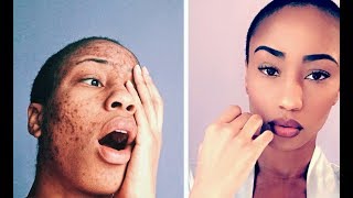 EVERYDAY MAKEUP ROUTINE ( how to cover dark marks ) EVERYDAY MAKEUP ROUTINE ( how to cover dark marks )