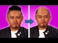 Men Find Out If They’ll Lose Their Hair