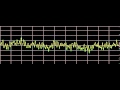 Bipolar Disorder - Rife Frequencies