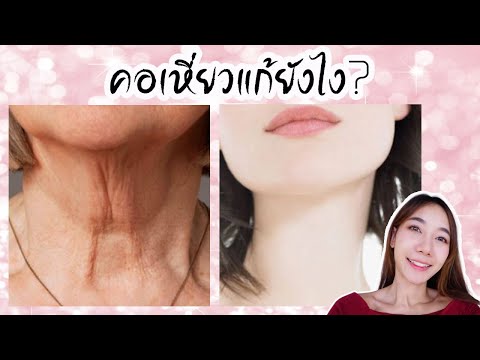 4 วิธีแก้คอเหี่ยว คอย่นก่อนวัย วิธีง่ายๆ ไม่เจ็บตัว | Cozy T