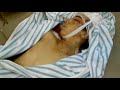 حماه اللطامنة الشهيد محمد رياض الأبرش