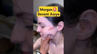 Nasdas Donne De Largent À Ya Devant Morgan