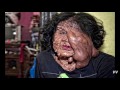 Doen As Raras E Anomalias 18 Imagens Fortes Doen As Raras E Anomalias 18 Imagens Fortes