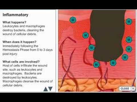 Wound Healing Process
