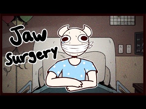 I had my jaw wired shut for 2 months