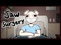 I had my jaw wired shut for 2 months thumbnail