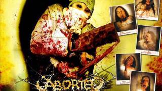 Watch Aborted Medical Deviance video