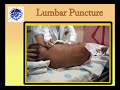Pediatric Lumbar puncture