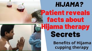 #what is cupping? Watch interview and #opnion about #cuppingtherapy / #Hijama by a Patient #sachin