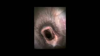 Example Telemetric Endoscopy A