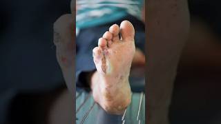 Diabetic Foot Care Tips Prevention Dos And Donts