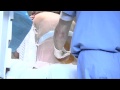 Anaesthesia | What Is An Epidural? | StreamingWell.com Anaesthesia | What Is An Epidural? | StreamingWell.com