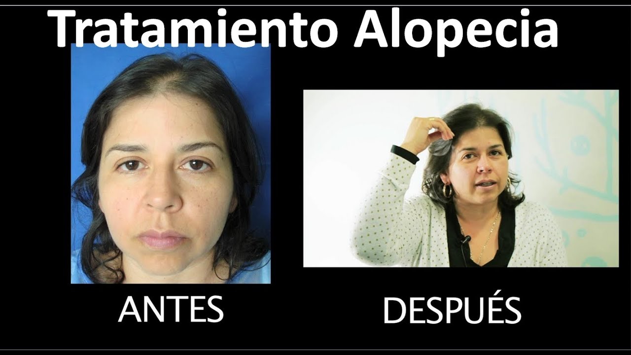 La máscara para los cabellos la alheña el kéfir la yema las revocaciones