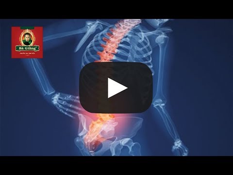 Thoái hoá cột sống và căn bệnh đau thắt lưng - CTQQT số 2