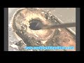 Toilet flange replacement cast iron
