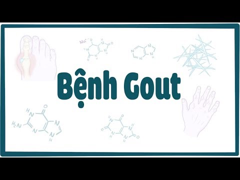 Bệnh Gout