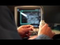 Advanced Needle Visualization for Primary Care - SonoSite Ultrasound