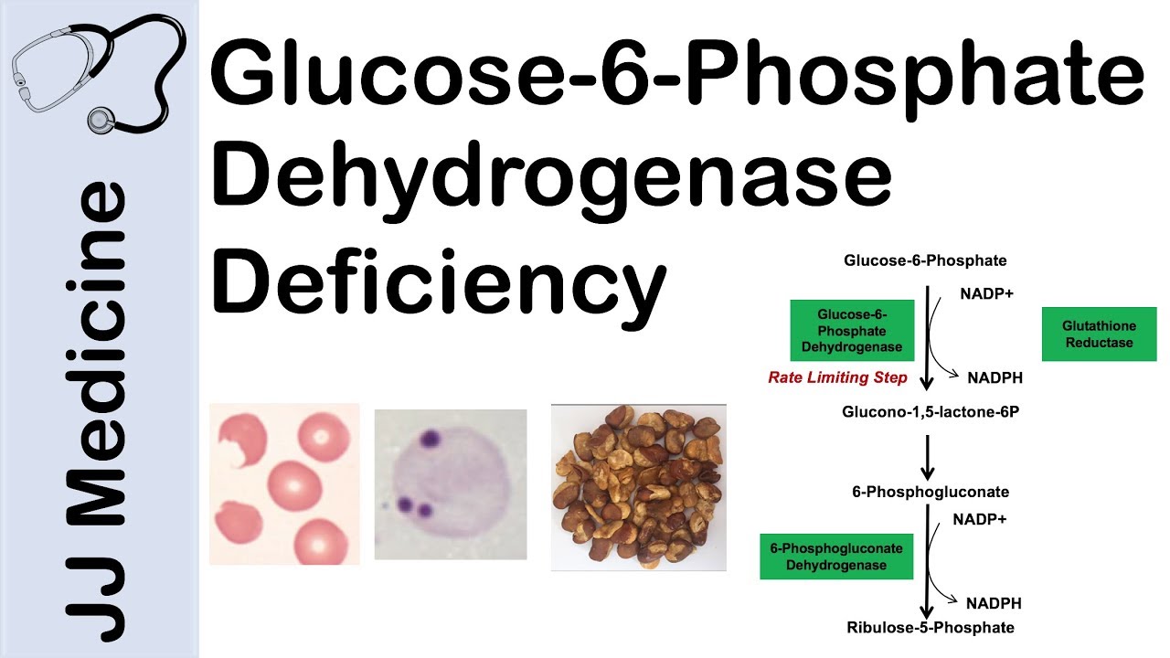 Cell deficiency diagnosis facial salt