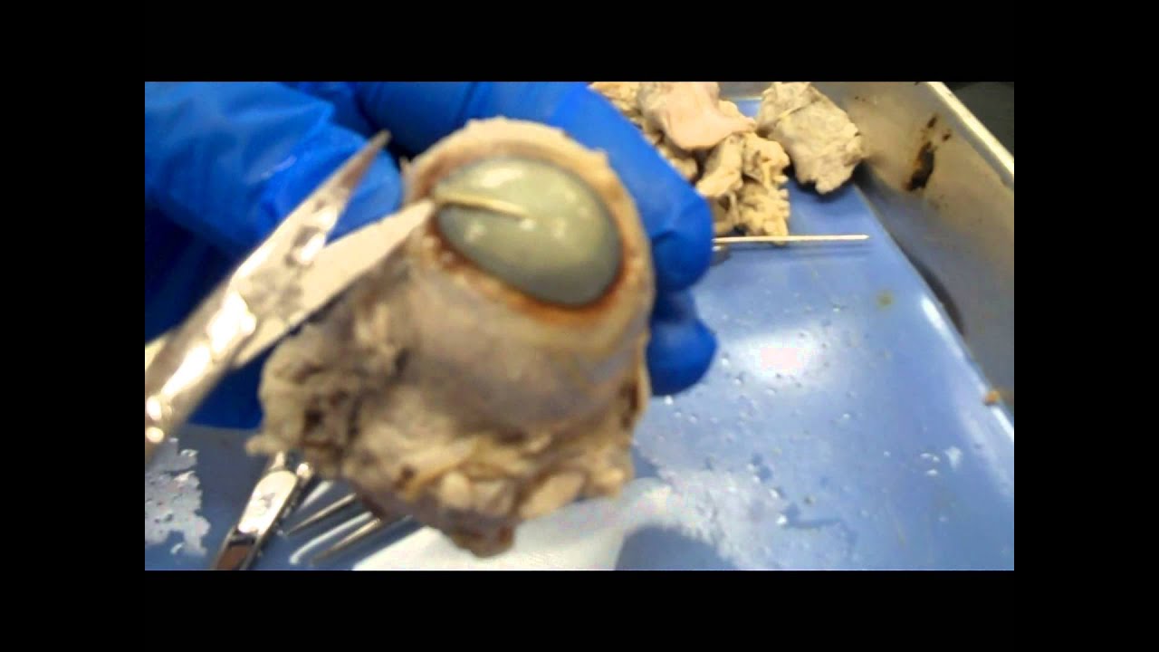 NEW - Cow Eye Dissection: Video Lab Series - YouTube