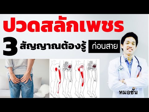 3 สัญญาณเตือน ปวดสลักเพชร กล้ามเนื้อสะโพกหนีบเส้นประสาท /ปวดสะโพก อาการ/หมอซัน drsuntv