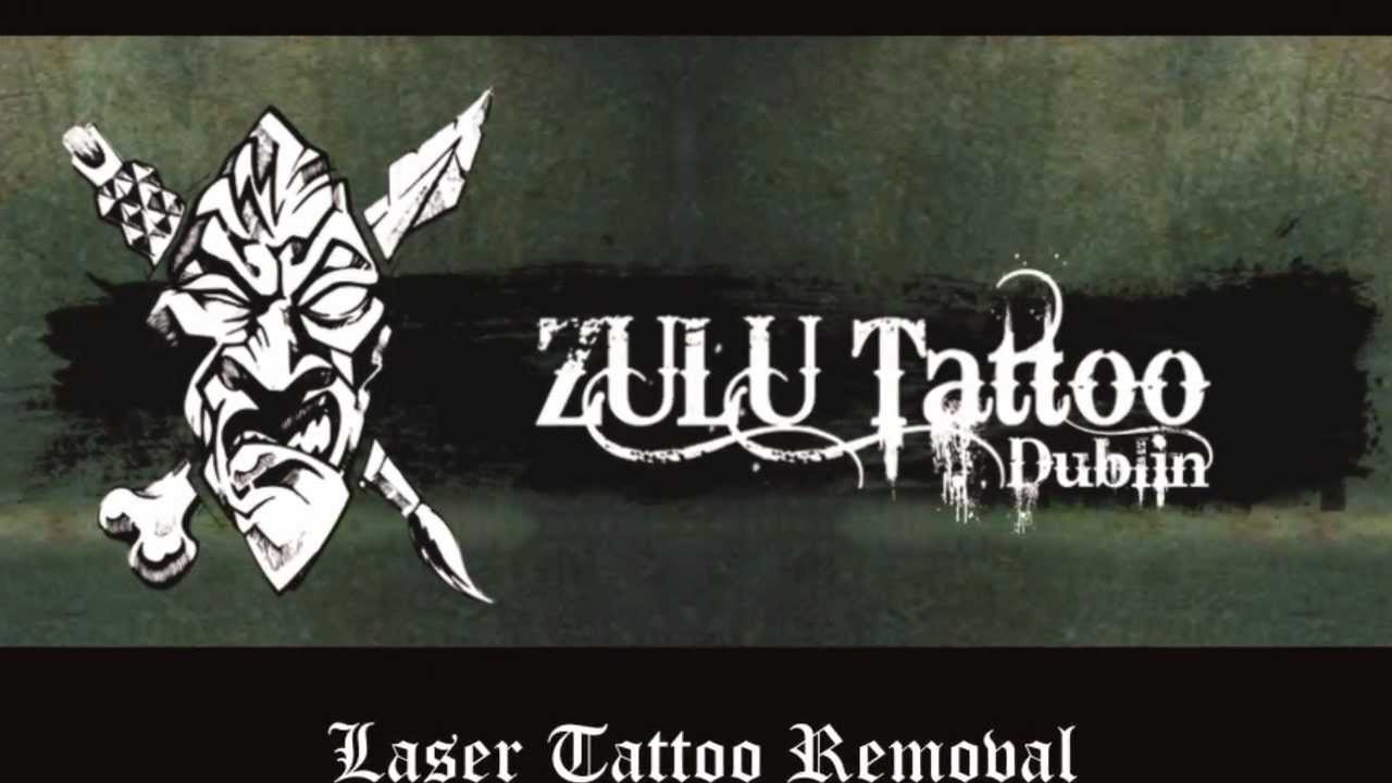 Tattoo Removal Dublin | Zulu Tattoo Dublin | Laser Tattoo Removal ...
