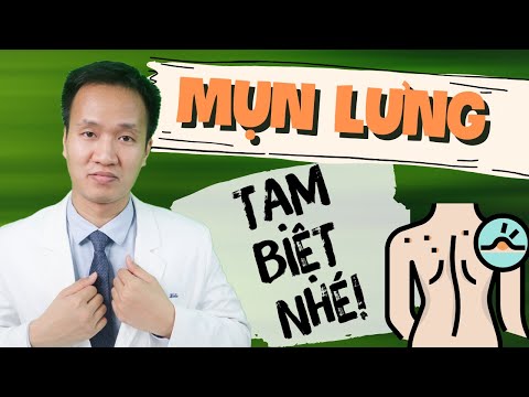Lưng xinh đón hè MỤN LƯNG Nguyên tắc xử lý mụn lưng | Dr Hiếu