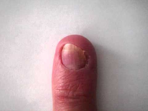 www.fingernailchronicle.com Watch a time lapse video of my complete