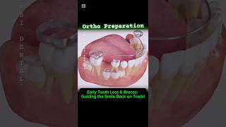 Ortho Preparation