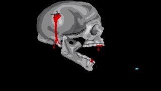 Nightmare Amiga Scareware