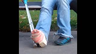 Clip 799 Broken Leg In A Perfect Slwc, Cast And Sock