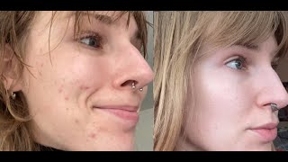 Amazing Ex-Vegan Transformation On Reddit