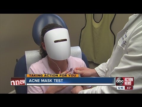 IlluMask Anti-Acne Light Therapy Mask Review serial5.ru IlluMask Anti-Acne Light Therapy Mask Review serial5.ru
