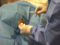 hepatic biopsy