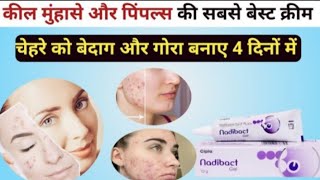 Nadibact Cream Use In Hindi कल महस और सकन इफकसन क सबस असरदर करम Nadibact Cream