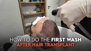 How To Do The First Wash After Hair Transplantation? I Murat Makascı Clinic New
