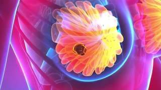 Dr. Vineetha Talks About Breast Cancer And How It Spreads
