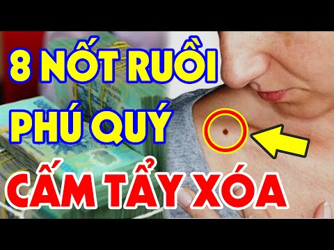 8 Nốt Ruồi ĐẠI PHÚ QUÝ Trên Cơ Thể Ai Có Được GIÀU SANG Hết Phần Thiên Hạ, Không Cần Đi Xem Bói