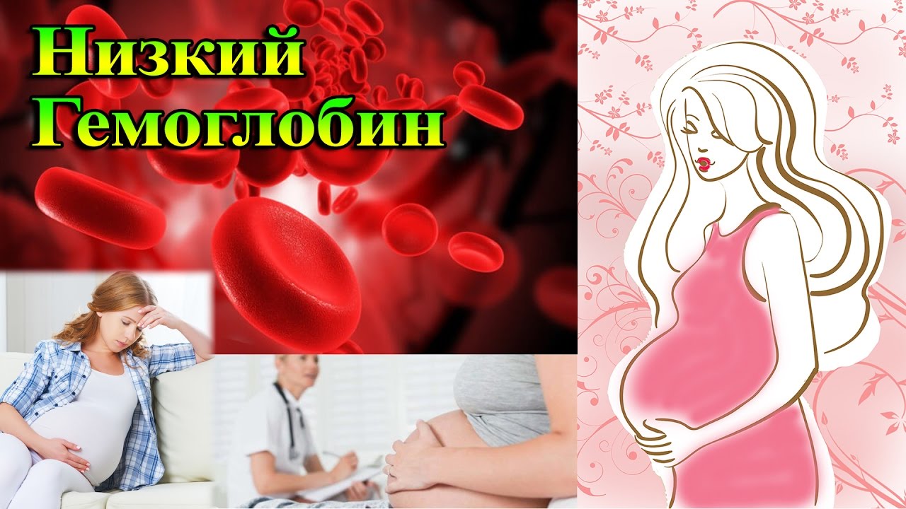 Низкий гемоглабин у беременной 83