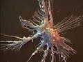 IMUNOTERAPIA COM CÉLULAS DENDRÍTICAS