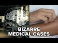 Bizarre Medical Cases That Still Confuse Doctors