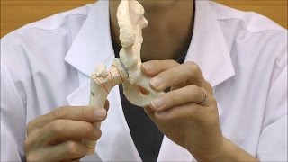 大腿骨骨折モデル：動画