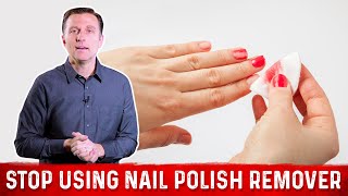 Why You Need to STOP Using Nail Polish Remover (Acetone) Why You Need to STOP Using Nail Polish Remover (Acetone)