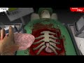 Surgeon Simulator 2013 - Gameplay Saving Bob