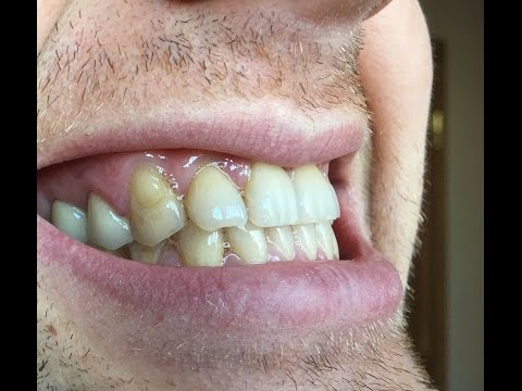 К чему снится Свадьба во сне по 90 сонникам! Ждем весну! Самые модные стрижки сезона весна-лето 2017