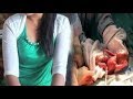 15 साल की लड़की ने दिया 7 महीने के बच्चे को जन्म,... thumbnail