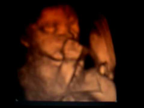 24 weeks pregnant 3d scan